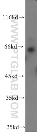 NUPL1 Antibody in Western Blot (WB)