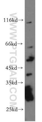 NUPL1 Antibody in Western Blot (WB)