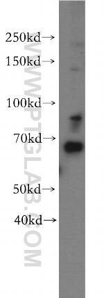 NUPL1 Antibody in Western Blot (WB)