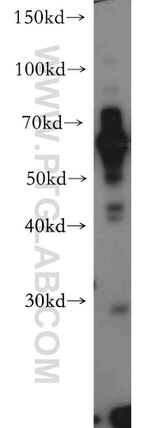 NUPL1 Antibody in Western Blot (WB)