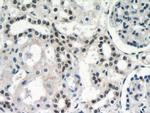 DDX17 Antibody in Immunohistochemistry (Paraffin) (IHC (P))