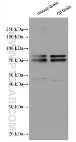 DDX17 Antibody in Western Blot (WB)
