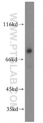 DDX17 Antibody in Western Blot (WB)