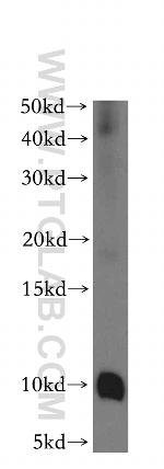 CHCHD7 Antibody in Western Blot (WB)