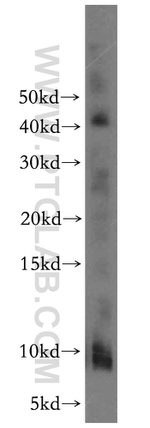 CHCHD7 Antibody in Western Blot (WB)
