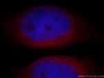 C20orf149 Antibody in Immunocytochemistry (ICC/IF)