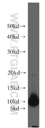C20orf149 Antibody in Western Blot (WB)