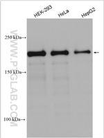 KDM3B Antibody in Western Blot (WB)