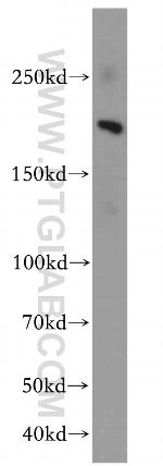 KDM3B Antibody in Western Blot (WB)