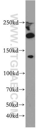 KDM3B Antibody in Western Blot (WB)