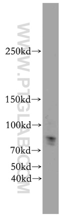 KDM3B Antibody in Western Blot (WB)