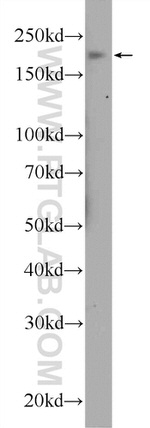 KDM3B Antibody in Western Blot (WB)