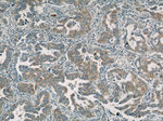 BZW1 Antibody in Immunohistochemistry (Paraffin) (IHC (P))