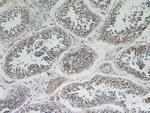 BZW1 Antibody in Immunohistochemistry (Paraffin) (IHC (P))