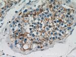 BZW1 Antibody in Immunohistochemistry (Paraffin) (IHC (P))