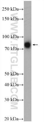 METT10D Antibody in Western Blot (WB)