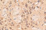 TMEM175 Antibody in Immunohistochemistry (Paraffin) (IHC (P))