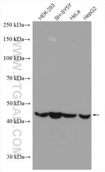 TMEM175 Antibody in Western Blot (WB)
