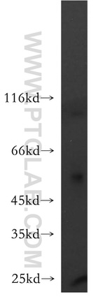 TMEM175 Antibody in Western Blot (WB)