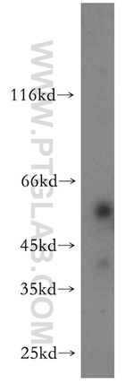 TMEM175 Antibody in Western Blot (WB)