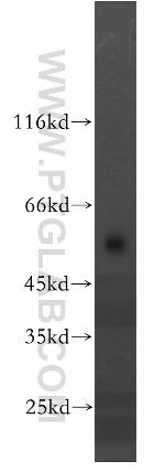 TMEM175 Antibody in Western Blot (WB)