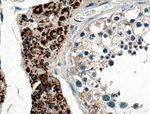 ZSCAN5A Antibody in Immunohistochemistry (Paraffin) (IHC (P))