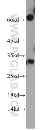 HEY1 Antibody in Western Blot (WB)