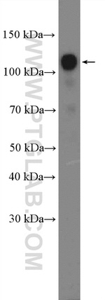 RBM5 Antibody in Western Blot (WB)