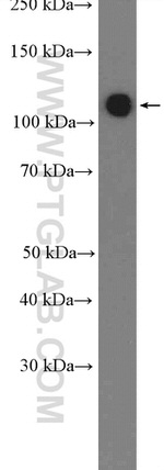 RBM5 Antibody in Western Blot (WB)