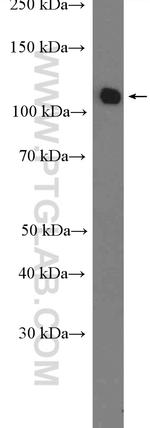RBM5 Antibody in Western Blot (WB)