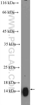 CST2 Antibody in Western Blot (WB)