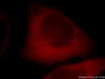 CYP1A2 Antibody in Immunocytochemistry (ICC/IF)