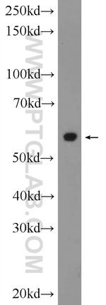 CYP2E1 Antibody in Western Blot (WB)