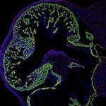 ERBB4 Antibody in Immunohistochemistry (Frozen) (IHC (F))