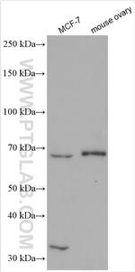 GNRHR Antibody in Western Blot (WB)