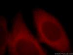 NMDAR2A Antibody in Immunocytochemistry (ICC/IF)