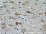 NMDAR2A Antibody in Immunohistochemistry (Paraffin) (IHC (P))