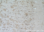 NMDAR2A Antibody in Immunohistochemistry (Paraffin) (IHC (P))