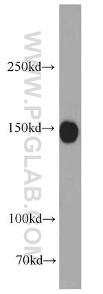 NMDAR2A Antibody in Western Blot (WB)