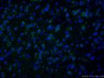 mGluR1 Antibody in Immunohistochemistry (PFA fixed) (IHC (PFA))