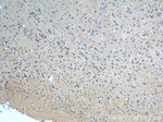 mGluR1 Antibody in Immunohistochemistry (Paraffin) (IHC (P))