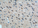 mGluR1 Antibody in Immunohistochemistry (Paraffin) (IHC (P))