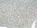 mGluR1 Antibody in Immunohistochemistry (Paraffin) (IHC (P))