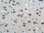 mGluR1 Antibody in Immunohistochemistry (Paraffin) (IHC (P))