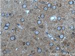 mGluR2 Antibody in Immunohistochemistry (Paraffin) (IHC (P))
