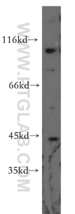 mGluR2 Antibody in Western Blot (WB)