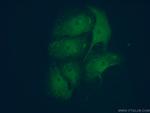 Huntingtin Antibody in Immunocytochemistry (ICC/IF)
