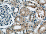GAC Antibody in Immunohistochemistry (Paraffin) (IHC (P))