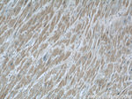 GAC Antibody in Immunohistochemistry (Paraffin) (IHC (P))