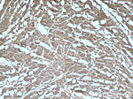 GAC Antibody in Immunohistochemistry (Paraffin) (IHC (P))